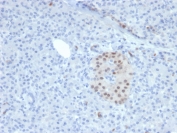 IHC staining of FFPE human pancreas with NKX6.1 antibody. HIER: boil tissue sections in pH6, 10mM citrate buffer, for 10-20 min and allow to cool before testing.