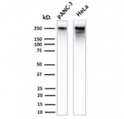 Western blot testing of human PANC-1 and HeLa cell lysate with recombinant Spectrin beta III antibody (clone SPTBN2/2894R). Predicted molecular weight ~246 kDa.
