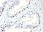 IHC testing of FFPE mouse prostate with p63 antibody (clone TP63/11). HIER: boil tissue sections in pH 9 10mM Tris with 1mM EDTA for 10-20 min followed by cooling at RT for 20 min.