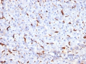 IHC testing of FFPE human liver tissue with Cathepsin K antibody (clone CTSK/2791). HIER: boil tissue sections in pH6, 10mM citrate buffer, for 10-20 min followed by cooling at RT for 20 min.