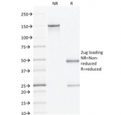 SDS-PAGE analysis of purified, BSA-free AMACR antibody (clone AMACR/1864) as confirmation of integrity and purity.