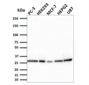 Western blot testing of human samples with Bcl2L2 antibody (clone CPTC-BCL2L2-2). Expected molecular weight ~26 kDa.