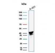 Western blot testing of human A431 cell lysate with SERPINB3 antibody. Predicted molecular weight ~46/39 kDa (two isoforms).