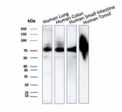 Western blot testing of human lung, colon, small intestine and tonsil tissue lysate with recombinant CD44 antibody (clone HCAM/2875R). Predicted molecular weight ~81 kDa but may be observed at higher molecular weights due to glycosylation.