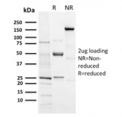 SDS-PAGE analysis of purified, BSA-free recombinant Aurora B antibody (clone AURKB/3121R) as confirmation of integrity and purity.