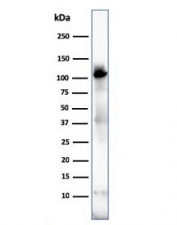 Western blot testing of human skeletal muscle lysate with Sarcomeric Alpha Actinin antibody (clone ACTN2/3292). Predicted molecular weigth ~103 kDa.