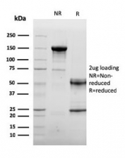 SDS-PAGE analysis of purified, BSA-free Sarcomeric Alpha Actinin antibody (clone ACTN2/3292) as confirmation of integrity and purity.