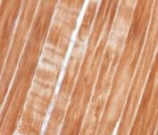 IHC staining of FFPE human skeletal muscle tissue with Sarcomeric Alpha Actinin antibody (clone SAMA-1). HIER: boil tissue sections in pH 9 10mM Tris with 1mM EDTA for 10-20 min and allow to cool before testing.