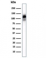 Western blot testing of human skeletal muscle lysate with Sarcomeric Alpha Actinin antibody (clone ACTN2/3293). Predicted molecular weigth ~103 kDa.