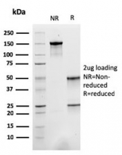 SDS-PAGE analysis of purified, BSA-free Sarcomeric Alpha Actinin antibody (clone ACTN2/3293) as confirmation of integrity and purity.