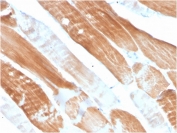 IHC staining of FFPE human skeletal muscle tissue with ACTN2 antibody (clone ACTN2/3291). HIER: boil tissue sections in pH 9 10mM Tris with 1mM EDTA for 10-20 min and allow to cool before testing.