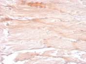IHC staining of FFPE skeletal muscle with Dystrophin antibody (clone DMD/3241). HIER: boil tissue sections in pH6, 10mM citrate buffer, for 10-20 min and allow to cool before testing.