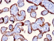 IHC staining of FFPE human placenta with PAPP-A antibody (clone PAPPA/2715). HIER: boil tissue sections in pH6, 10mM citrate buffer, for 10-20 min and allow to cool before testing.