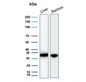 Western blot testing of human liver and human Ramos cell lysate with Prohibitin antibody (clone PHB/3226). Expected molecular weight ~30 kDa.
