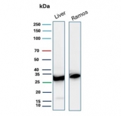 Western blot testing of human liver and Ramos cell lysate with Prohibitin antibody (clone PHB/3225). Expected molecular weight ~30 kDa.