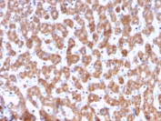IHC testing of FFPE human liver tissue with PHB antibody (clone PHB/3228). Required HIER: boil tissue sections in pH6, 10mM citrate buffer, for 10-20 min followed by cooling at RT for 20 min.