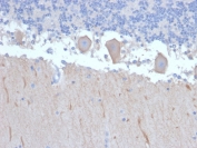 IHC staining of FFPE human brain with ATG5 antibody (clone ATG5/2492). HIER: boil tissue sections in pH 9 10mM Tris with 1mM EDTA for 10-20 min and allow to cool before testing.