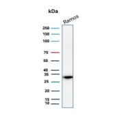 Western blot testing of human Ramos cell lysate with Prohibitin antibody (clone PHB/3231). Expected molecular weight ~30 kDa.