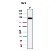 Western blot testing of human small intestine tissue lysate with recombinant Cadherin 17 antibody. Predicted molecular weight ~92 kDa but may be observed at higher molecular weights due to glycosylation.