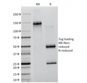 SDS-PAGE analysis of purified, BSA-free Creatine kinase B antibody (clone CKB/1268) as confirmation of integrity and purity.