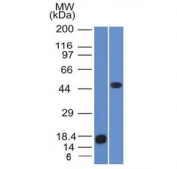 Western blot testing of a recombinant partial protein (immunogen, left) and human Jurkat cell lysate (right) with Adipophilin antibody (clone ADFP/1365). Predicted/observed molecular weight ~48 kDa.