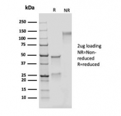 SDS-PAGE analysis of purified, BSA-free recombinant Adipophilin antibody (clone rADFP/1493) as confirmation of integrity and purity.
