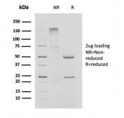 SDS-PAGE analysis of purified, BSA-free Cystatin A antibody (clone CPTC-CSTA-1) as confirmation of integrity and purity.