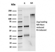 SDS-PAGE analysis of purified, BSA-free Estrogen Receptor alpha antibody (clone ESR1/3559) as confirmation of integrity and purity.
