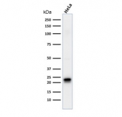 Western blot testing of human HeLa cell lysate with FTH1 antibody (clone FTH/2081). Predicted molecular weight ~21 kDa.
