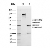 SDS-PAGE analysis of purified, BSA-free recombinant FTL antibody (clone rFTL/1388) as confirmation of integrity and purity.
