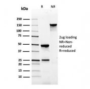 SDS-PAGE analysis of purified, BSA-free Gastrin antibody (clone GAST/2634) as confirmation of integrity and purity.