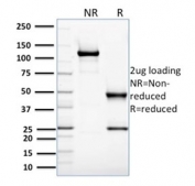 SDS-PAGE analysis of purified, BSA-free Glyoxalase 1 antibody (clone CPTC-GLO1-3) as confirmation of integrity and purity.