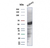 Western blot testing of human kidney tissue lysate with Glucose 6-Phosphate Isomerase antibody. Predicted molecular weight: ~63 kDa.