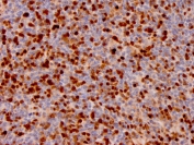 IHC staining of FFPE human lymph node with Annexin A1 antibody (clone ANXA1/3566). HIER: boil tissue sections in pH 9 10mM Tris with 1mM EDTA for 10-20 min and allow to cool before testing.