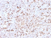 IHC staining of FFPE human spleen with recombinant Lambda antibody (clone LLC/3778R). HIER: boil tissue sections in pH 9 10mM Tris with 1mM EDTA for 20 min and allow to cool before testing.