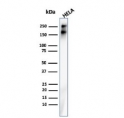 Western blot testing of human HeLa cell lysate with recombinant Spectrin beta III antibody. Predicted molecular weight ~246 kDa.