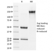SDS-PAGE analysis of purified, BSA-free Cytokeratin 15 antibody (clone KRT15/2957) as confirmation of integrity and purity.