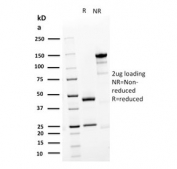 SDS-PAGE analysis of purified, BSA-free Desmoglein 3 antibody (clone DSG3/2839) as confirmation of integrity and purity.