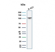 Western blot testing of human A431 cell lysate with MCM6 antibody. Expected molecular weight: 92-105 kDa.