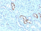 IHC staining of FFPE human kidney with CALB1 antibody (clone CALB1/3333). HIER: boil tissue sections in pH 9 10mM Tris with 1mM EDTA for 20 min and allow to cool before testing.