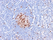 IHC staining of FFPE human tonsil with PCNA antibody (clone PC5). HIER: boil tissue sections in pH 9 10mM Tris with 1mM EDTA for 20 min and allow to cool before testing.