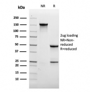 SDS-PAGE analysis of purified, BSA-free recombinant CD31 antibody (clone rC31.3) as confirmation of integrity and purity.