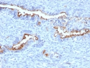IHC staining of FFPE human endometrium with Podocalyxin antibody (clone PODXL/2184). HIER: boil tissue sections in pH 9 10mM Tris with 1mM EDTA for 20 min and allow to cool before testing.