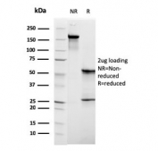 SDS-PAGE analysis of purified, BSA-free C1QB antibody (clone C1QB/2961) as confirmation of integrity and purity.