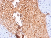 IHC staining of FFPE human lung with Alpha II Spectrin antibody (clone SPTAN1/3352). HIER: boil tissue sections in pH6, 10mM citrate buffer, for 20 min and allow to cool before testing.
