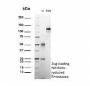 SDS-PAGE analysis of purified, BSA-free BRCA1 antibody (clone BRCA1/2986) as confirmation of integrity and purity.