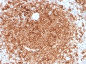 IHC staining of FFPE human spleen with GMCSF antibody (clone CSF2/3403). HIER: boil tissue sections in pH 9 10mM Tris with 1mM EDTA for 10-20 min and allow to cool before testing.