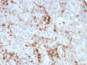 IHC staining of FFPE human spleen with GMCSF antibody (clone CSF2/3403). HIER: boil tissue sections in pH 9 10mM Tris with 1mM EDTA for 10-20 min and allow to cool before testing.