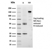 SDS-PAGE analysis of purified, BSA-free Tyrosinase-Related Protein-1 antibody (clone TYRP1/3280) as confirmation of integrity and purity.