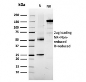 SDS-PAGE analysis of purified, BSA-free Tyrosinase-Related Protein-1 antibody (clone TYRP1/3281) as confirmation of integrity and purity.